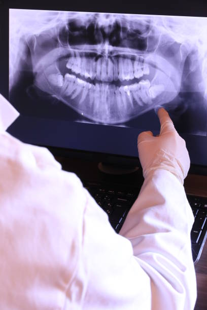 Best Emergency Wisdom Teeth Removal in Rosepine, LA