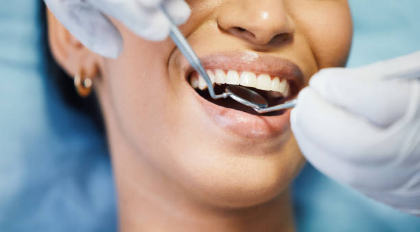 Best Emergency Dental Care for Trauma or Injury in Rosepine, LA